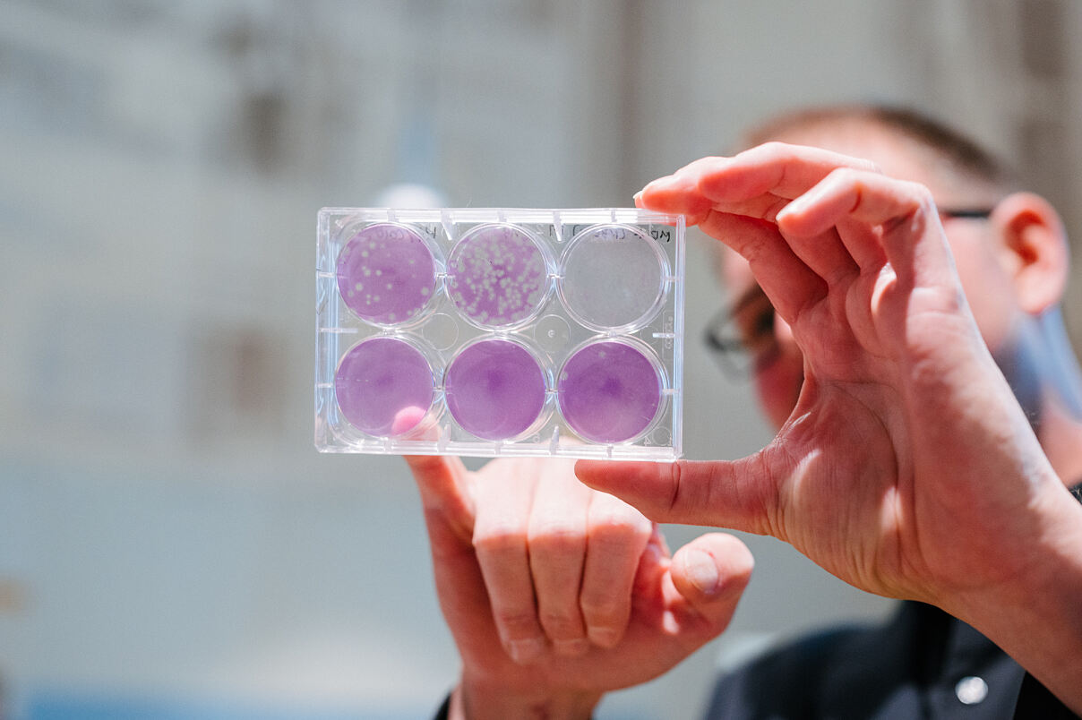 Forschung am LBI SOAP